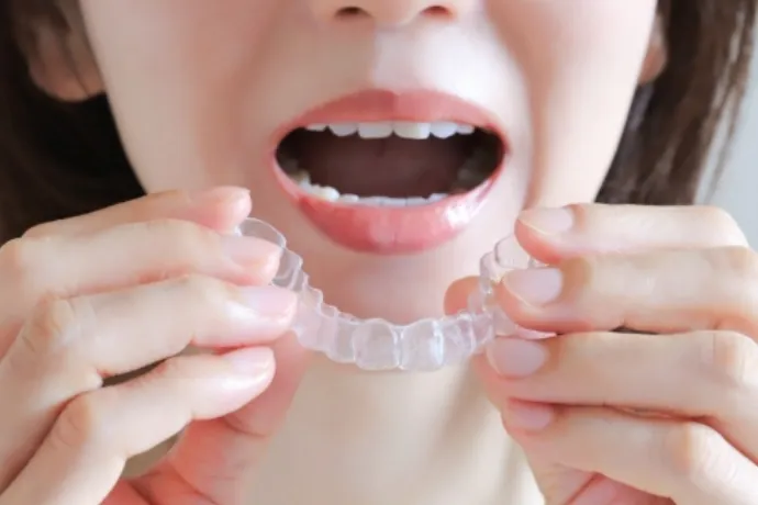 歯科矯正の画像